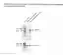 Fig. 07 - LSAMP Gene Associated With Cardiovascular Disease