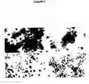 Fig. 03 - Prostate-specific membrane antigen