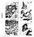 Fig. 04 - Prostate-specific membrane antigen