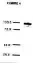 Fig. 05 - Prostate-specific membrane antigen