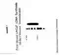Fig. 08 - Prostate-specific membrane antigen