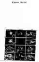 Fig. 04 - Compositions and methods for inhibiting EB-1-mediated microtubule stability