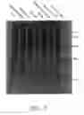 Fig. 07 - Protein fragment complementation assays for the detection of biological or drug interactions