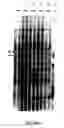 Fig. 02 - PROTEIN PRESENT AT THE SURFACE OF HEMATOPOIETIC STEM CELLS OF THE LYMPHOID LINE AND OF NK CELLS, AND USES THEREOF