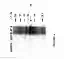 Fig. 08 - PROTEIN PRESENT AT THE SURFACE OF HEMATOPOIETIC STEM CELLS OF THE LYMPHOID LINE AND OF NK CELLS, AND USES THEREOF