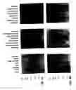 Fig. 11 - KCNQ2 potassium channels