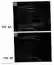 Fig. 15 - KCNQ2 potassium channels