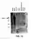 Fig. 24 - KCNQ2 potassium channels