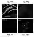 Fig. 25 - KCNQ2 potassium channels