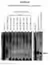 Fig. 58 - Yeast expression vectors for production of ITF