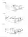 Fig. 07 - Biological sample discrimination device, biological sample discriminating method, and biological sample discriminating plate