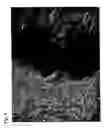 Fig. 05 - Method for preparing stem cells from fat tissue