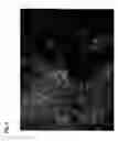 Fig. 06 - Method for preparing stem cells from fat tissue