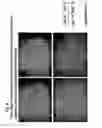 Fig. 10 - Method for preparing stem cells from fat tissue