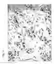 Fig. 12 - Method for preparing stem cells from fat tissue