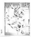 Fig. 13 - Method for preparing stem cells from fat tissue