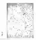 Fig. 14 - Method for preparing stem cells from fat tissue
