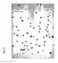 Fig. 15 - Method for preparing stem cells from fat tissue