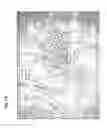 Fig. 16 - Method for preparing stem cells from fat tissue