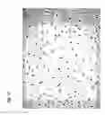 Fig. 18 - Method for preparing stem cells from fat tissue