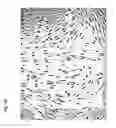 Fig. 19 - Method for preparing stem cells from fat tissue