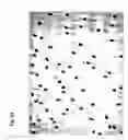 Fig. 24 - Method for preparing stem cells from fat tissue