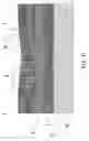 Fig. 12 - Method for realizing a multispacer structure, use of said structure as a mold and circuital architectures obtained from said mold