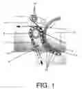 Fig. 02 - Needled belt with high thickness and elasticity