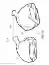Fig. 10 - Method for making a picnic roast and the resultant product
