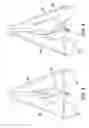 Fig. 04 - Golf swing training apparatus