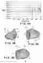 Fig. 04 - Golf club head