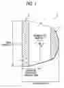 Fig. 02 - Putter head