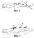 Fig. 05 - KNEE REHABILITATION DEVICE
