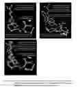 Fig. 13 - Method of treating and/or preventing cancers using Sartans and/or Statins to modulate VDR, and/or PPAR, and/or GCR and/or CB1 receptors; in conjunction with certain bacteriostatic antibiotics