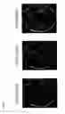 Fig. 06 - Controlled Release Delivery System for Nasal Applications and Method of Treatment