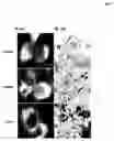 Fig. 09 - Methods and compounds for modulating triglyceride and vldl secretion