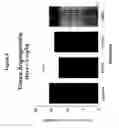 Fig. 16 - Cancer therapy