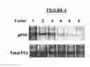 Fig. 05 - Method of inhibiting FLT3 kinase