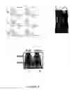Fig. 10 - Anticancer agents and use