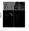 Fig. 07 - Methods of use for 2,5-dihydroxybenzene sulfonic acid compounds for the treatment of cancer, rosacea and psoriasis