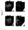 Fig. 08 - Methods of use for 2,5-dihydroxybenzene sulfonic acid compounds for the treatment of cancer, rosacea and psoriasis