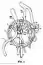 Fig. 04 - Surgical devices for imposing a negative pressure to stabilize the cardiac tissue during surgery