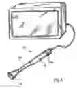 Fig. 05 - Diagnostic device for tubular anatomical structures