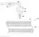 Fig. 01 - Needle-septum interface for a fluidic analyzer