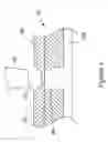 Fig. 06 - Needle-septum interface for a fluidic analyzer