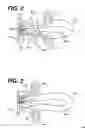 Fig. 03 - Ultrasonic diagnostic imaging with blended tissue harmonic signals