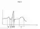 Fig. 04 - Portable electrocardiogram measurement device