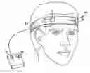 Fig. 01 - METHOD AND APPARATUS FOR RELIEF OF HEADACHE
