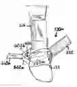Fig. 01 - Counterforce brace