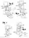 Fig. 03 - Counterforce brace